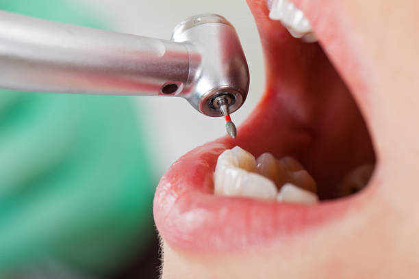 Best Pediatric Emergency Dentist in Cold Spring, KY